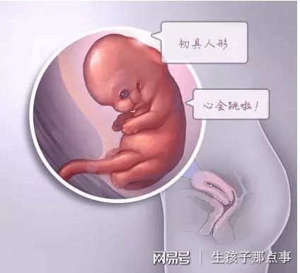 单基因病案例